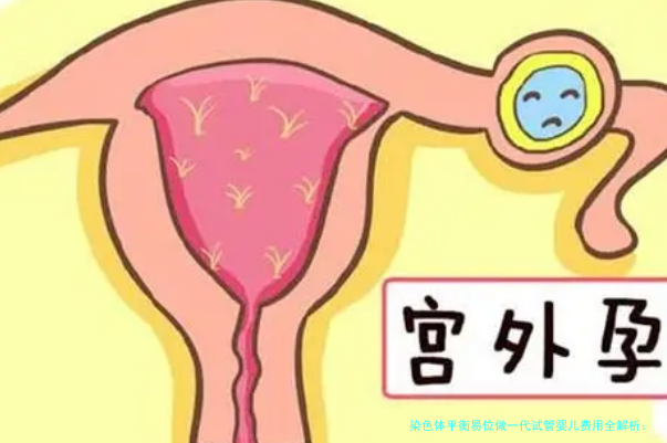 染色体平衡易位做一代试管婴儿费用全解析：从检查到成功，你需知的费用细节