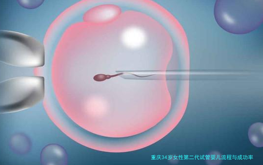 重庆34岁女性第二代试管婴儿流程与成功率全解析
