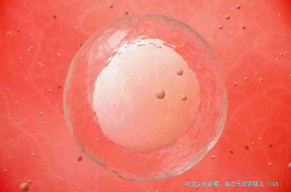 40岁女性必看：第二代试管婴儿（ICSI）操作流程全解析