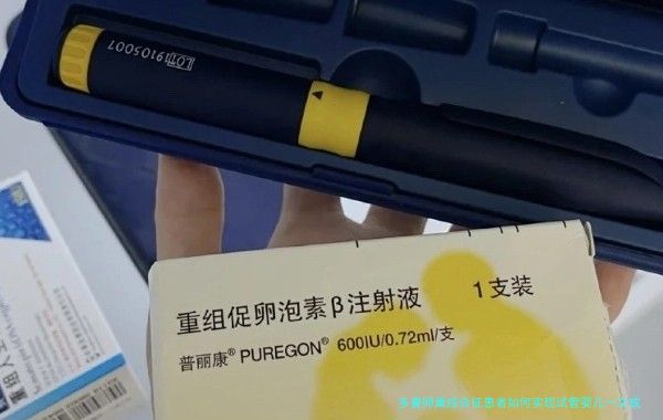 多囊卵巢综合征患者如何实现试管婴儿一次成功：实用指南与经验分享