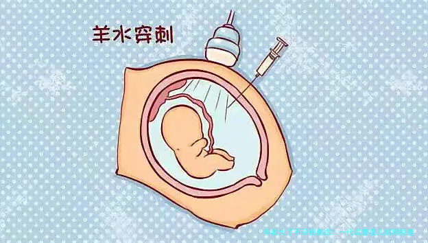 年龄大了不孕别焦虑！一代试管婴儿前期检查流程全解析，助你轻松备战