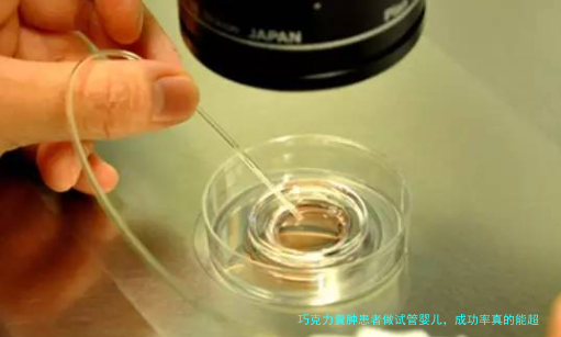 巧克力囊肿患者做试管婴儿，成功率真的能超过70%吗？