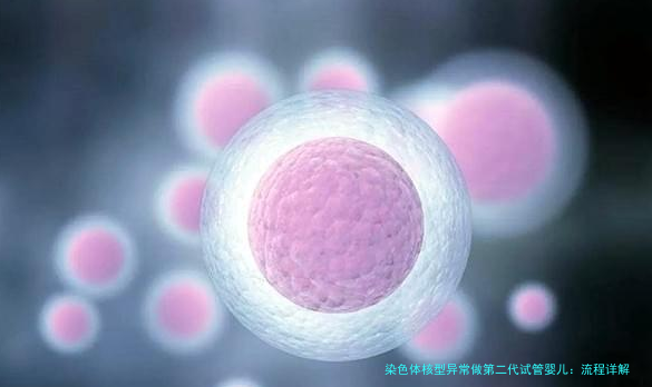 染色体核型异常做第二代试管婴儿：流程详解与成功率全攻略