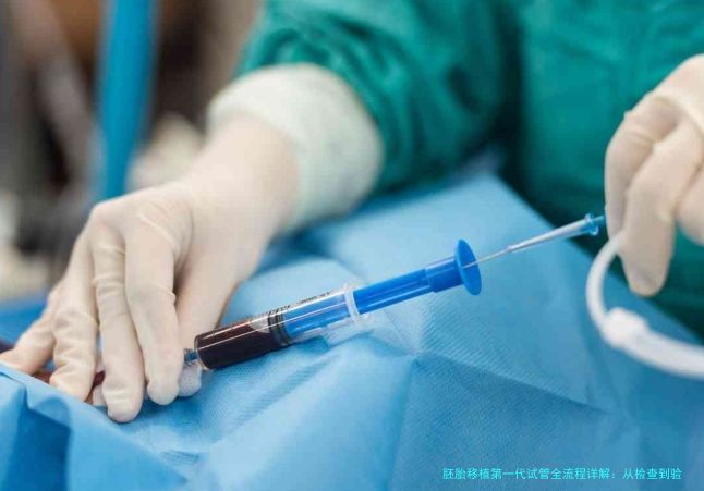 胚胎移植第一代试管全流程详解：从检查到验孕的完整时间表