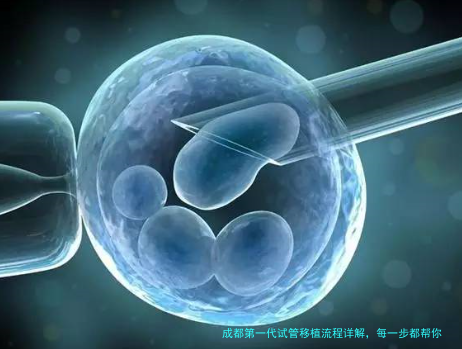 成都第一代试管移植流程详解，每一步都帮你捋清楚