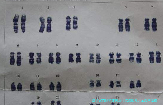 抗子宫内膜抗体做三代试管婴儿,全周期流程详解(附注意事项)