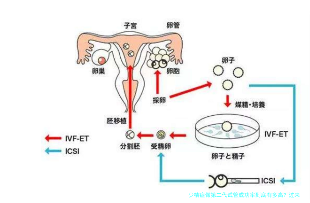 少精症做第二代试管成功率到底有多高?过来人告诉你真实情况
