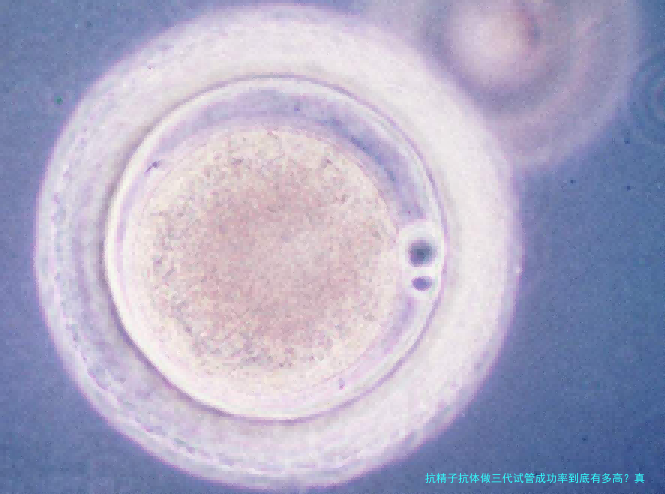 抗精子抗体做三代试管成功率到底有多高?真实案例告诉你