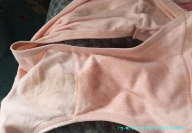 子宫内膜厚度不足做第三代试管成功率能有多少？真实案例告诉你答案