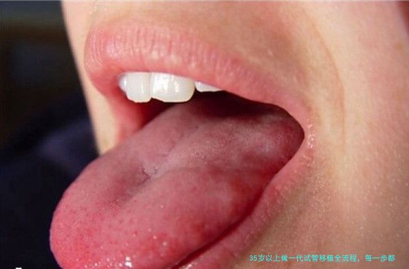 35岁以上做一代试管移植全流程，每一步都别踩坑