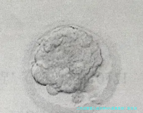二代试管婴儿成功率80%是真是假？医生说出大实话