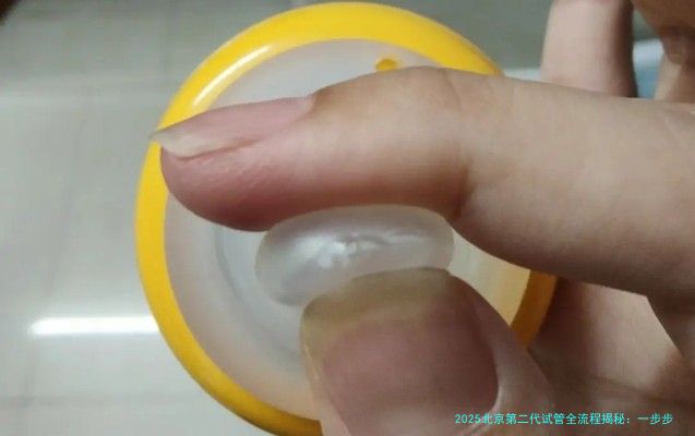2025北京第二代试管全流程揭秘:一步步带你走进希望之路