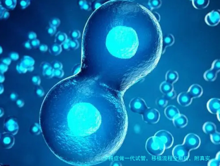 少精症做一代试管，移植流程全解析，附真实案例