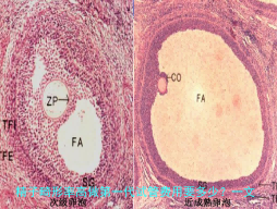 精子畸形率高做第一代试管费用要多少？一文详解！