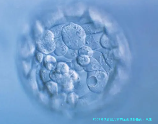 PCOS做试管婴儿前的全面准备指南：从生活到检查，助你提高成功率
