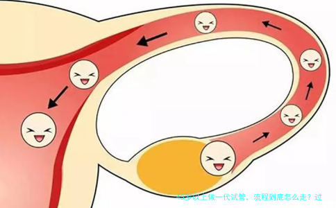 45岁以上做一代试管，流程到底怎么走？过来人告诉你每一步