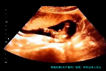 移植后第6天严重吗？别慌，听听过来人怎么说