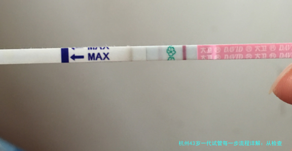 杭州43岁一代试管每一步流程详解：从检查到移植的完整指南
