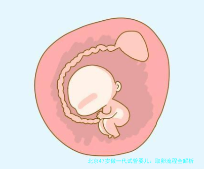 北京47岁做一代试管婴儿：取卵流程全解析（附关键注意事项）