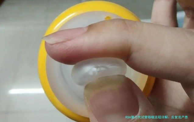 RSA第三代试管移植流程详解：反复流产患者的希望之路