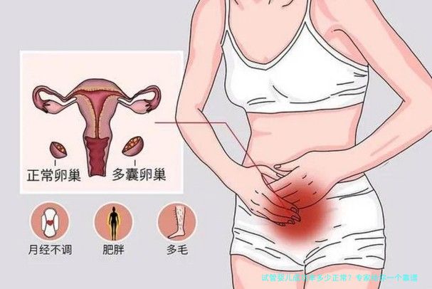 试管婴儿成功率多少正常？专家给你一个靠谱的答案
