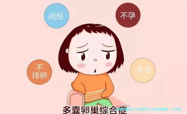 多囊卵巢做三代试管婴儿全流程揭秘！从检查到移植每一步都讲透
