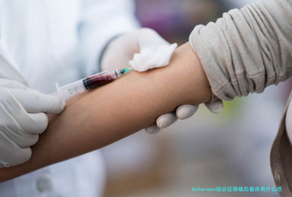 Asherman综合征移植后着床有什么感觉?别瞎猜,听我说!