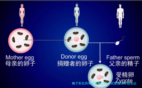 精子形态异常患者看过来！试管成功率排名出炉，你的情况排第几？
