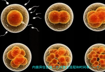 内膜异位症做二代试管全流程和时间表：一个过来人的详细拆解