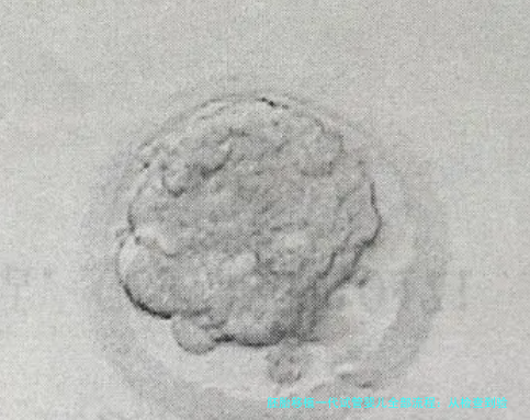 胚胎移植一代试管婴儿全部流程：从检查到验孕，每一步都在这