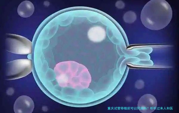 重庆试管移植前可以同房吗？听听过来人和医生的实在话