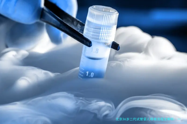 北京36岁二代试管婴儿移植流程全解析：一位过来人的经验分享