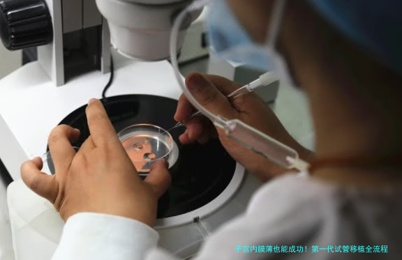 子宫内膜薄也能成功！第一代试管移植全流程揭秘