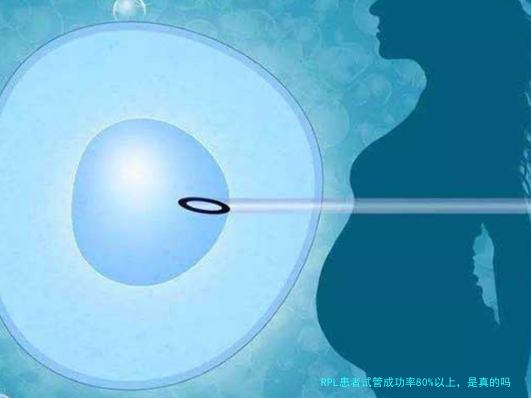 RPL患者试管成功率80%以上，是真的吗？医生告诉你答案