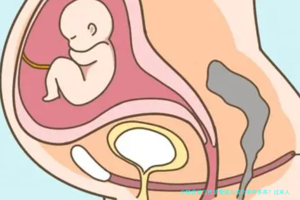 少精症做三代试管婴儿成功率有多高？过来人经验分享