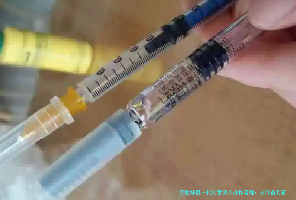 胚胎移植一代试管婴儿操作流程：从准备到着床的每一步都讲透