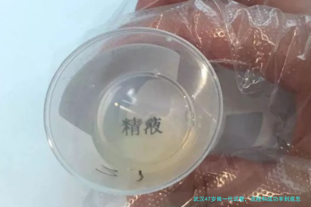 武汉47岁做一代试管，流程和成功率到底怎么样？