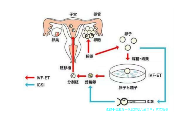 成都中信湘雅一代试管婴儿成功率：真实数据与经验分享