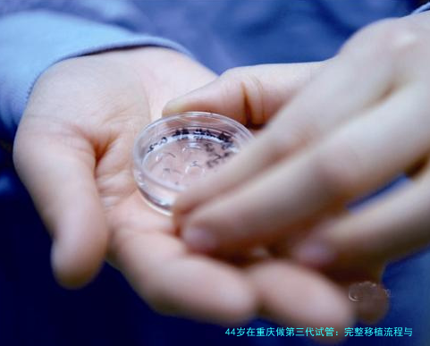 44岁在重庆做第三代试管：完整移植流程与经验分享