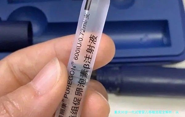 重庆30岁一代试管婴儿移植流程全解析：从准备到验孕，一个过来人的真实分享
