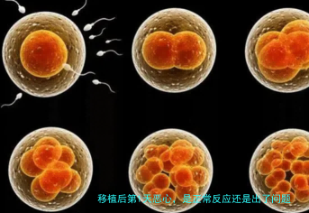移植后第1天恶心，是正常反应还是出了问题？