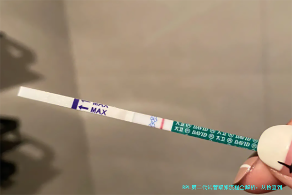 RPL第二代试管取卵流程全解析:从检查到取卵的每一步