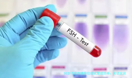 50岁子宫内膜异位症试管成功率：实话实说，别被“奇迹”忽悠了