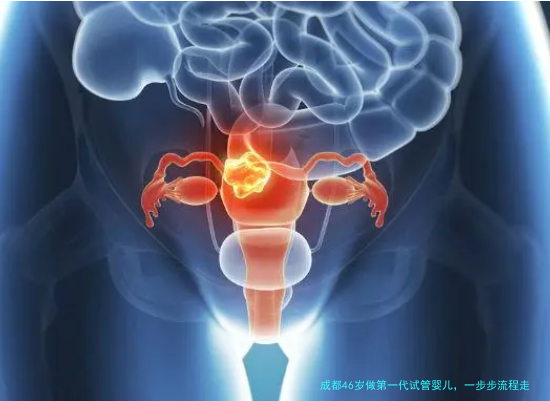 成都46岁做第一代试管婴儿，一步步流程走下来，这些坑千万别踩