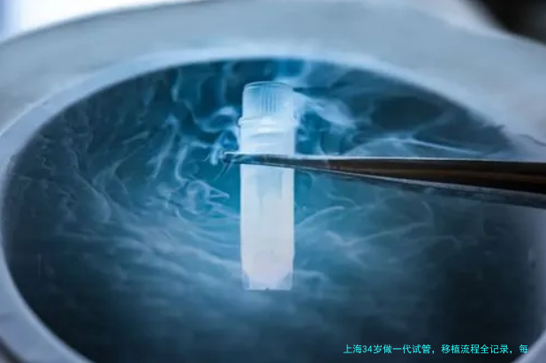 上海34岁做一代试管，移植流程全记录，每一步都讲清楚