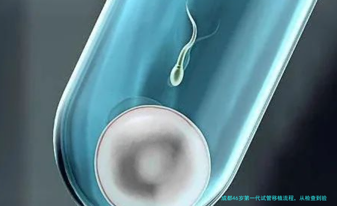 成都46岁第一代试管移植流程，从检查到验孕每一步都说明白