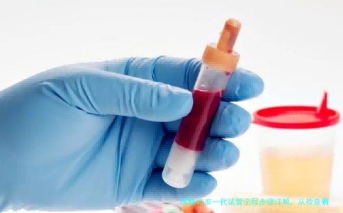 成都45岁一代试管流程步骤详解，从检查到验孕一步不落