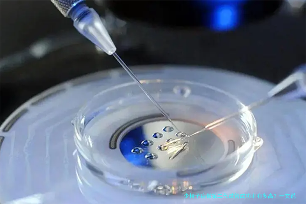 少精子症做第二代试管成功率有多高？一文说清关键因素