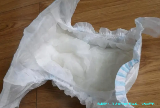 卵巢囊肿二代试管移植流程详解：从术前评估到移植后注意事项