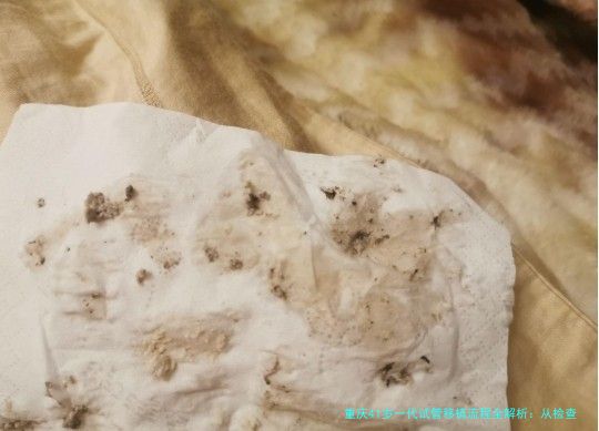重庆41岁一代试管移植流程全解析：从检查到验孕，每一步都关键